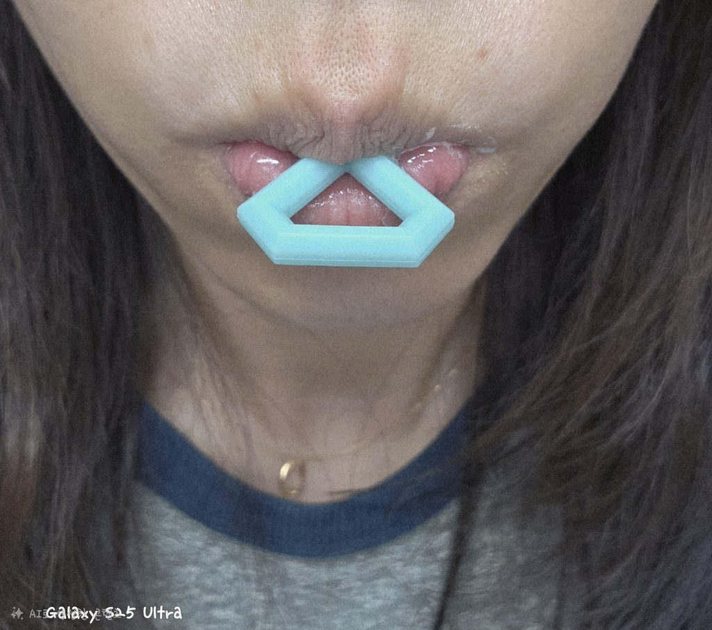 A close-up selfie of a woman wearing a light blue silicone mouth tray for teeth whitening treatment, with the front handle resting between her lips.